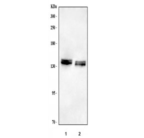 Western blot testing of 1) rat brain and 2) mouse brain tissue lysate with NCAN antibody. Predicted molecular weight ~143 kDa (unmodified), up to ~250 kDa (fully glycosylated).