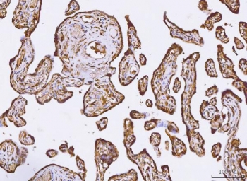 IHC staining of FFPE human placental tissue with PKI beta antibody. HIER: boil tissue sections in pH8 EDTA for 20 min and allow to cool before testing.