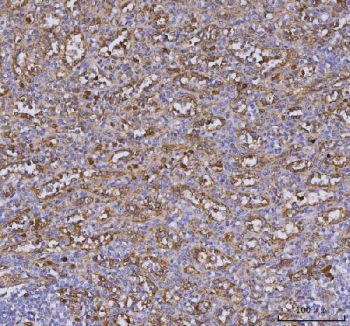 IHC staining of FFPE human spleen tissue with TLR9 antibody. HIER: boil tissue sections in pH8 EDTA for 20 min and allow to cool before testing.