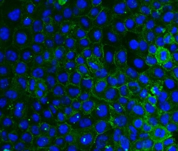 Immunofluorescent staining of FFPE human A431 cells with Integrin beta 4 antibody (green) and DAPI nuclear stain (blue). HIER: steam section in pH6 citrate buffer for 20 min.