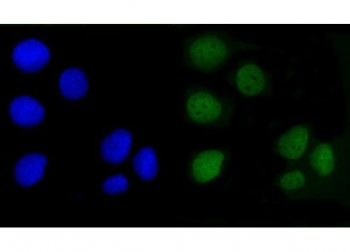 Immunofluorescent staining of FFPE human Caco-2 cells with Angiomotin antibody (green) and DAPI nuclear stain (blue). HIER: steam section in pH6 citrate buffer for 20 min.