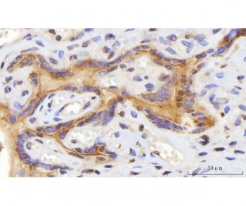 IHC staining of FFPE human placental tissue with CEP250 antibody. HIER: boil tissue sections in pH8 EDTA for 20 min and allow to cool before testing.