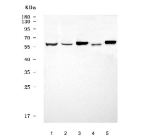 Western blot testing of 1) human SH-SY5Y, 2) human SiHa, 3) rat brain, 4) rat spleen and 5) mouse brain tissue lysate with GPR161 antibody. Predicted molecular weight ~59 kDa.