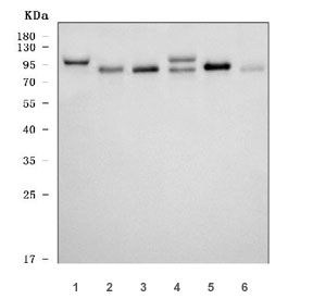 Western blot testing of 1) human 293T, 2) human HeLa, 3) human placenta, 4) rat testis, 5) rat H9c2(2-1) cells and 6) mouse testis tissue lysate with MCM8 antibody. Expected molecular weight ~94/89 kDa (isoforms 1/2).