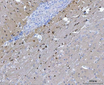IHC staining of FFPE mouse brain tissue with NOS1AP antibody. HIER: boil tissue sections in pH8 EDTA for 20 min and allow to cool before testing.