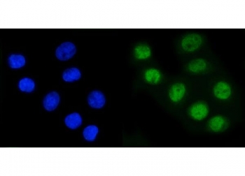 Immunofluorescent staining of FFPE human SiHa cells with RAD21 antibody (green) and DAPI nuclear stain (blue). HIER: steam section in pH6 citrate buffer for 20 min.