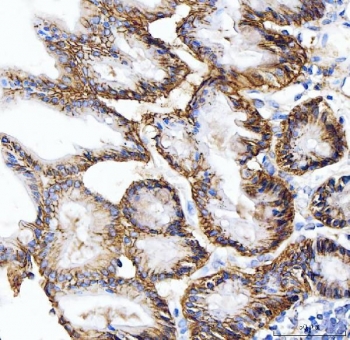 IHC staining of FFPE mouse stomach tissue with Carbonic Anhydrase IX antibody. HIER: boil tissue sections in pH8 EDTA for 20 min and allow to cool before testing.