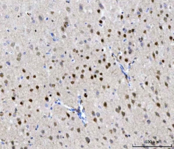 IHC staining of FFPE mouse brain tissue with CHD1 antibody. HIER: boil tissue sections in pH8 EDTA for 20 min and allow to cool before testing.