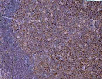 IHC staining of FFPE human tonsil tissue with Eg5 antibody. HIER: boil tissue sections in pH8 EDTA for 20 min and allow to cool before testing.
