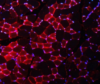 Immunofluorescent staining of FFPE mouse skeletal muscle with Nedd4 antibody (red) and DAPI nuclear stain (blue). HIER: steam section in pH8 EDTA buffer for 20 min.