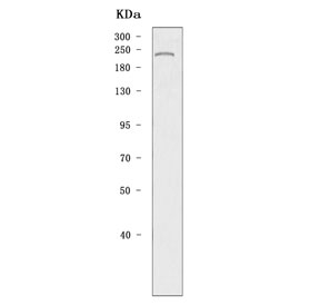 Western blot testing of mouse testis tissue lysate with DNA methyltransferase 1 antibody. Predicted molecular weight: 180-200 kDa.