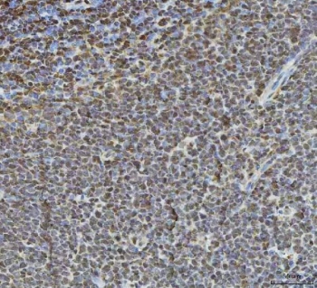 IHC staining of FFPE human tonsil tissue with Histone deacetylase 1 antibody. HIER: boil tissue sections in pH8 EDTA for 20 min and allow to cool before testing.