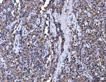 IHC staining of FFPE human testicular germ cell tumor tissue with ACO2 antibody. HIER: boil tissue sections in pH8 EDTA for 20 min and allow to cool before testing.