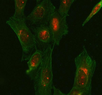 Immunofluorescent staining of FFPE human U-2 OS cells with Glycogen synthase kinase-3 beta antibody (red) and Beta Tubulin mAb (green). HIER: steam section in pH6 citrate buffer for 20 min.