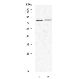 Western blot testing of 1) rat brain and 2) rat C6 cell lysate with 5-HT2C Receptor antibody. Predicted molecular weight: ~52 kDa, but may be observed at higher molecular weights due to glycosylation.