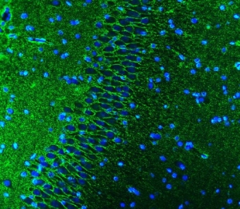 Immunofluorescent staining of FFPE rat brain tissue with EAAT1 antibody (green) and DAPI nuclear stain (blue). HIER: steam section in pH8 EDTA buffer for 20 min.
