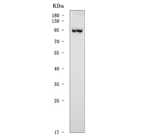 Western blot testing of human HEL cell lysate with SATB2 antibody. Predicted molecular weight ~83 kDa but commonly observed at up to ~100 kDa.