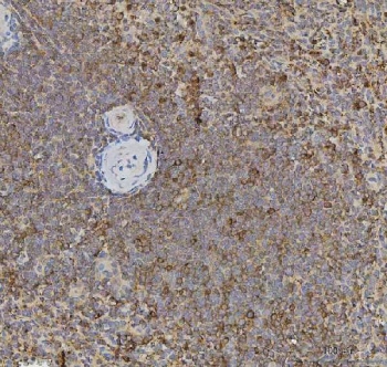 IHC staining of FFPE human spleen tissue with XCR1 antibody. HIER: boil tissue sections in pH8 EDTA for 20 min and allow to cool before testing.
