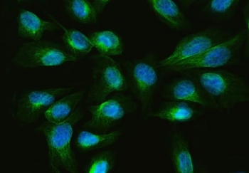 Immunofluorescent staining of FFPE human U-2 OS cells with ARL13B antibody (green) and DAPI nuclear stain (blue). HIER: steam section in pH6 citrate buffer for 20 min.