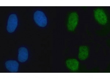 Immunofluorescent staining of FFPE human U-2 OS cells with ZMYM2 antibody (green) and DAPI nuclear stain (blue). HIER: steam section in pH6 citrate buffer for 20 min.