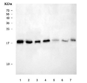 Western blot testing of 1) rat liver, 2) rat pancreas, 3) rat NRK, 4) mouse liver, 5) mouse pancreas, 6) rat stomach and 7) mouse HEPA1-6 cell lysate with RPL32 antibody. Predicted molecular weight ~18 kDa.