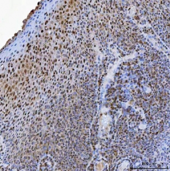 IHC staining of FFPE human tonsil tissue with USP26 antibody. HIER: boil tissue sections in pH8 EDTA for 20 min and allow to cool before testing.