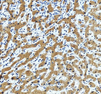 IHC staining of FFPE human liver tissue with ERGIC1 antibody, HRP-labeled secondary and DAB substrate. HIER: boil tissue sections in pH8 EDTA for 20 min and allow to cool before testing.