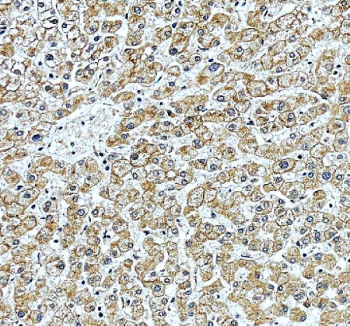 IHC staining of FFPE human liver tissue with Protein O-glucosyltransferase 3 antibody, HRP-secondary and DAB substrate. HIER: boil tissue sections in pH8 EDTA for 20 min and allow to cool before testing.