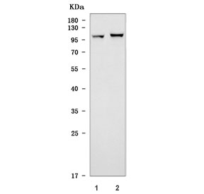 Western blot testing of 1) rat brain and 2) mouse brain tissue lysate with Toll-like receptor 5 antibody. Expected molecular weight ~98 kDa.