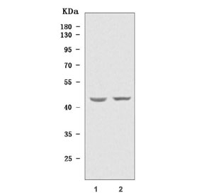 Western blot testing of human 1) Caco-2 and 2) A549 cell lysate with TIMD4 antibody. Predicted molecular weight ~42 kDa.