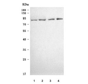 Western blot testing of 1) human T-47D, 2) rat kidney, 3) mouse kidney and 4) mouse small intestine tissue lysate with Scinderin antibody. Predictec molecular weight ~80 kDa.