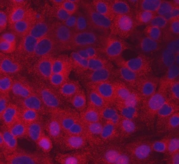 Immunofluorescent staining of FFPE human A549 cells with CVAK104 antibody (red) and DAPI nuclear stain (blue). HIER: steam section in pH6 citrate buffer for 20 min.