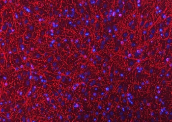 Immunofluorescent staining of FFPE rat brain tissue with CNP antibody (red) and DAPI nuclear stain (blue). HIER: boil tissue sections in pH8 EDTA for 20 min and allow to cool before testing.
