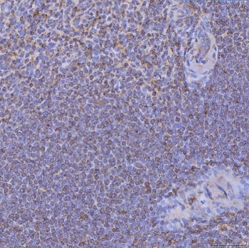 IHC staining of FFPE human spleen tissue with CD74 antibody. HIER: boil tissue sections in pH8 EDTA for 20 min and allow to cool before testing.