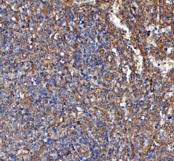 IHC staining of FFPE human spleen tissue with FERMT2 antibody. HIER: boil tissue sections in pH8 EDTA for 20 min and allow to cool before testing.