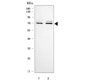 Western blot testing of human 1) MOLT4 and 2) Daudi cell lysate with CAT-3 antibody. Predicted molecular weight ~67 kDa.