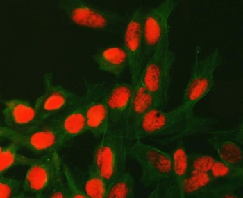 Immunofluorescent staining of FFPE human U-2 OS cells with APG4C antibody (red) and Alpha Tubulin mAb (green). HIER: steam section in pH6 citrate buffer for 20 min.