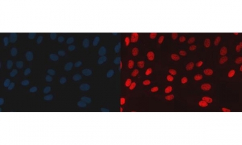 Immunofluorescent staining of FFPE human U-2 OS cells with BAF57 antibody (red) and DAPI nuclear stain (blue). HIER: steam section in pH6 citrate buffer for 20 min.