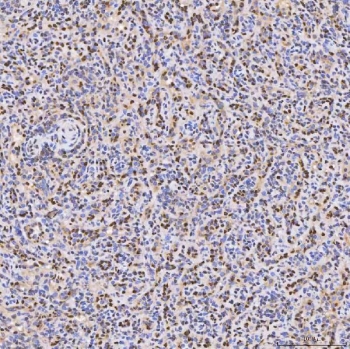 IHC staining of FFPE human spleen tissue with PAO-1 antibody. HIER: boil tissue sections in pH8 EDTA for 20 min and allow to cool before testing.
