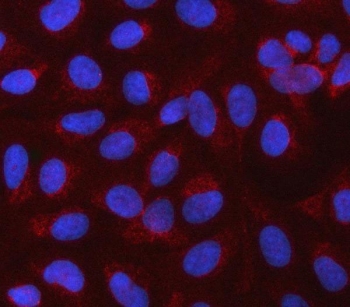 Immunofluorescent staining of FFPE human U-2 OS cells with CBLIF antibody (red) and DAPI nuclear stain (blue). HIER: steam section in pH6 citrate buffer for 20 min.