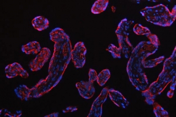 Immunofluorescent staining of FFPE human placental tissue with Small ribosomal subunit protein uS7 antibody (red) and DAPI nuclear stain (blue). HIER: steam section in pH8 EDTA buffer for 20 min.
