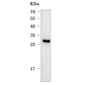 Western blot testing of rat liver tissue lysate with Mis18b antibody. Predicted molecular weight ~25 kDa.