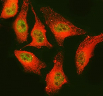 Immunofluorescent staining of FFPE human A549 cells with PAPSS2 antibody (green) and Alpha Tubulin mAb (red). HIER: steam section in pH6 citrate buffer for 20 min.