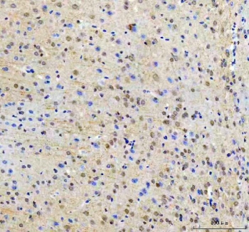 IHC staining of FFPE mouse brain tissue with RTF1 antibody. HIER: boil tissue sections in pH8 EDTA for 20 min and allow to cool before testing.