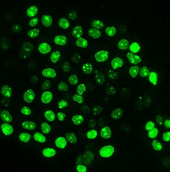 Immunofluorescent staining of FFPE human A431 cells with Ki67 antibody. HIER: steam section in pH6 citrate buffer for 20 min.