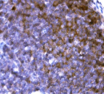 IHC staining of FFPE rat lymph node tissue with Cd19 antibody. HIER: boil tissue sections in pH8 EDTA for 20 min and allow to cool before testing.