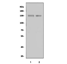 Western blot testing of 1) rat brain and 2) mouse brain tissue lysate with NTRK3 antibody. Predicted molecular weight ~94 kDa but may be observed a higher molecular weights due to glycosylation.