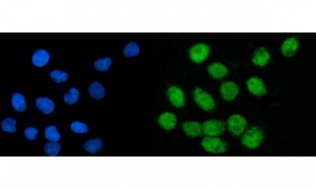 Immunofluorescent staining of FFPE human SiHa cells with CoREST antibody (green) and DAPI nuclear stain (blue). HIER: steam section in pH6 citrate buffer for 20 min.