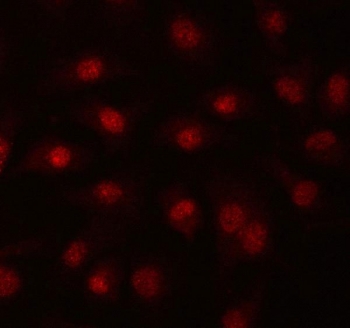 Immunofluorescent staining of FFPE human A549 cells with PRPF39 antibody. HIER: steam section in pH6 citrate buffer for 20 min.