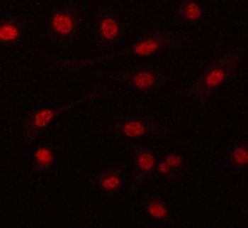 Immunofluorescent staining of FFPE human A549 cells with PRPF6 antibody. HIER: steam section in pH6 citrate buffer for 20 min.